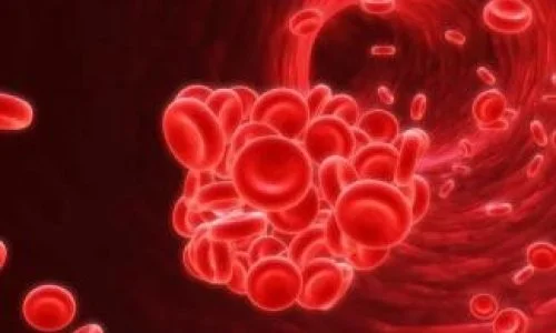 blood-clot