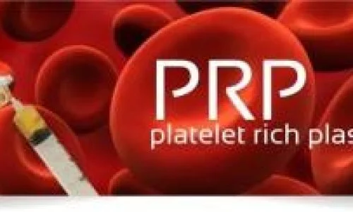 prp-orthopaedics